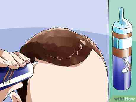 Image titled Treat Male Pattern Hair Loss Step 2