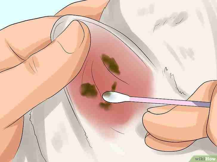 Titel afbeelding Get Rid of Ear Mites in a Cat Step 9