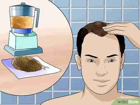 Image titled Treat Male Pattern Hair Loss Step 11