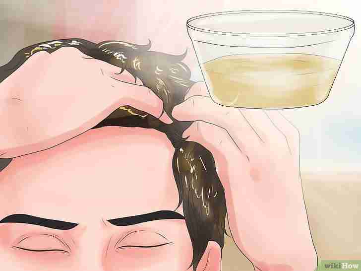 Image intitulée Make Your Hairline Grow Back Step 5