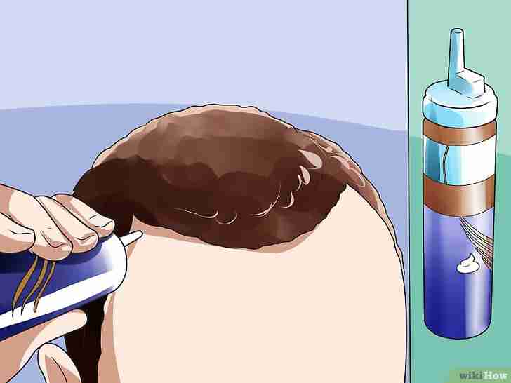 Titel afbeelding Treat Male Pattern Hair Loss Step 2