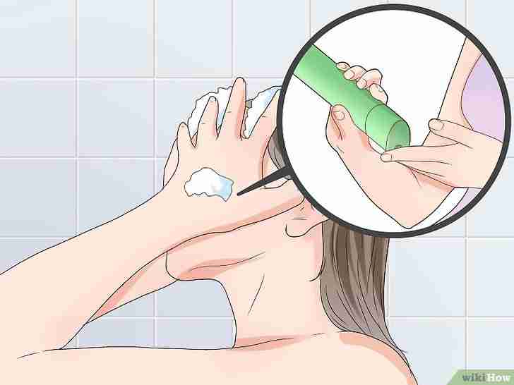 Imagen titulada Treat Scalp Pimples Step 11