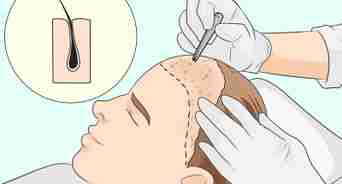 detener la caída del cabello con remedios naturales