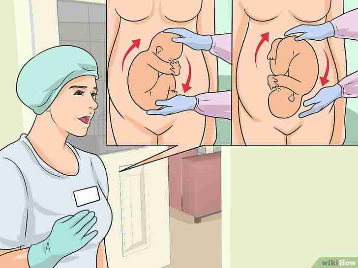Image intitulée Avoid a Cesarean Section Step 12