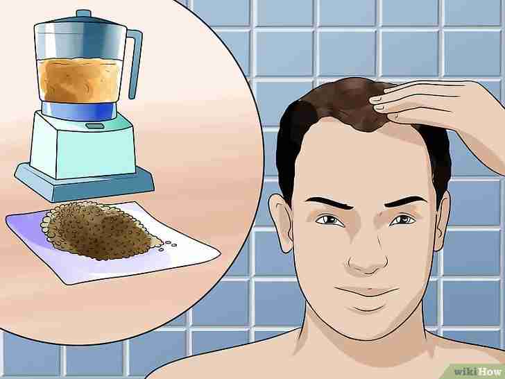 以Treat Male Pattern Hair Loss Step 11为标题的图片