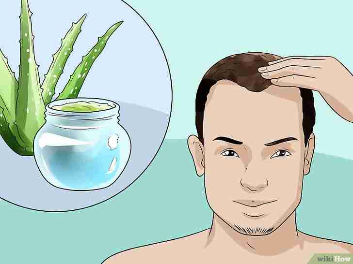 以Treat Male Pattern Hair Loss Step 12为标题的图片